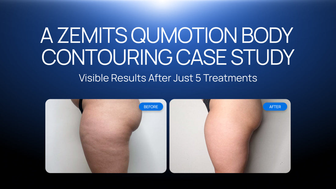 Visible Results After Just 5 Treatments: A Zemits QuMotion Body Contouring Case Study