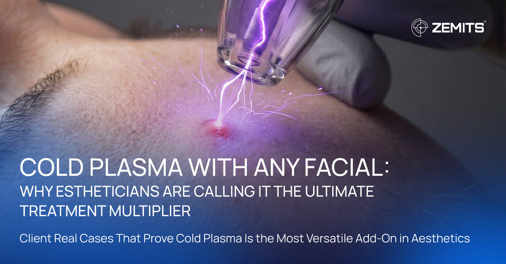Cold Plasma with Any Facial: Why Estheticians Are Calling It the Ultimate Treatment Multiplier