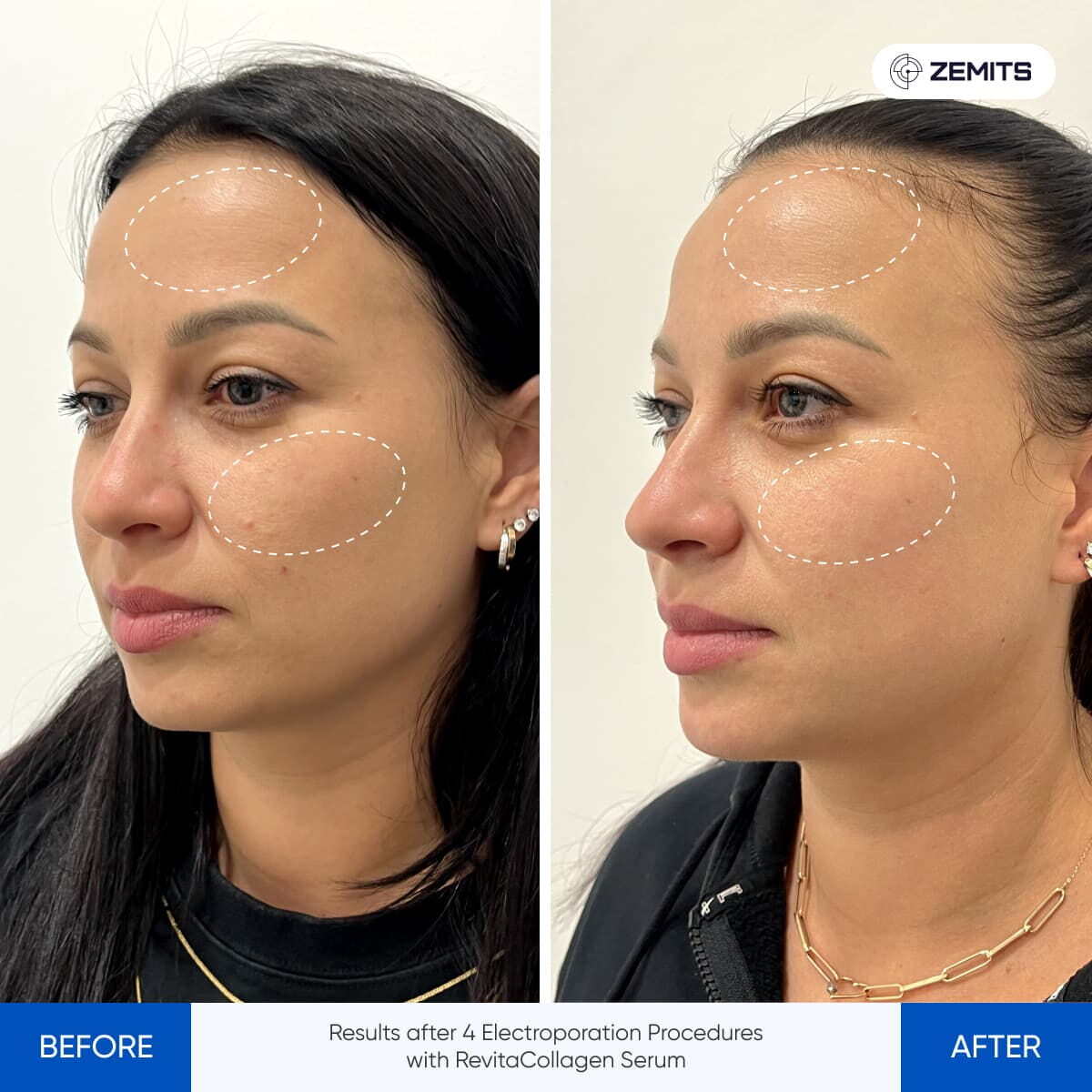 Before After Slide 1