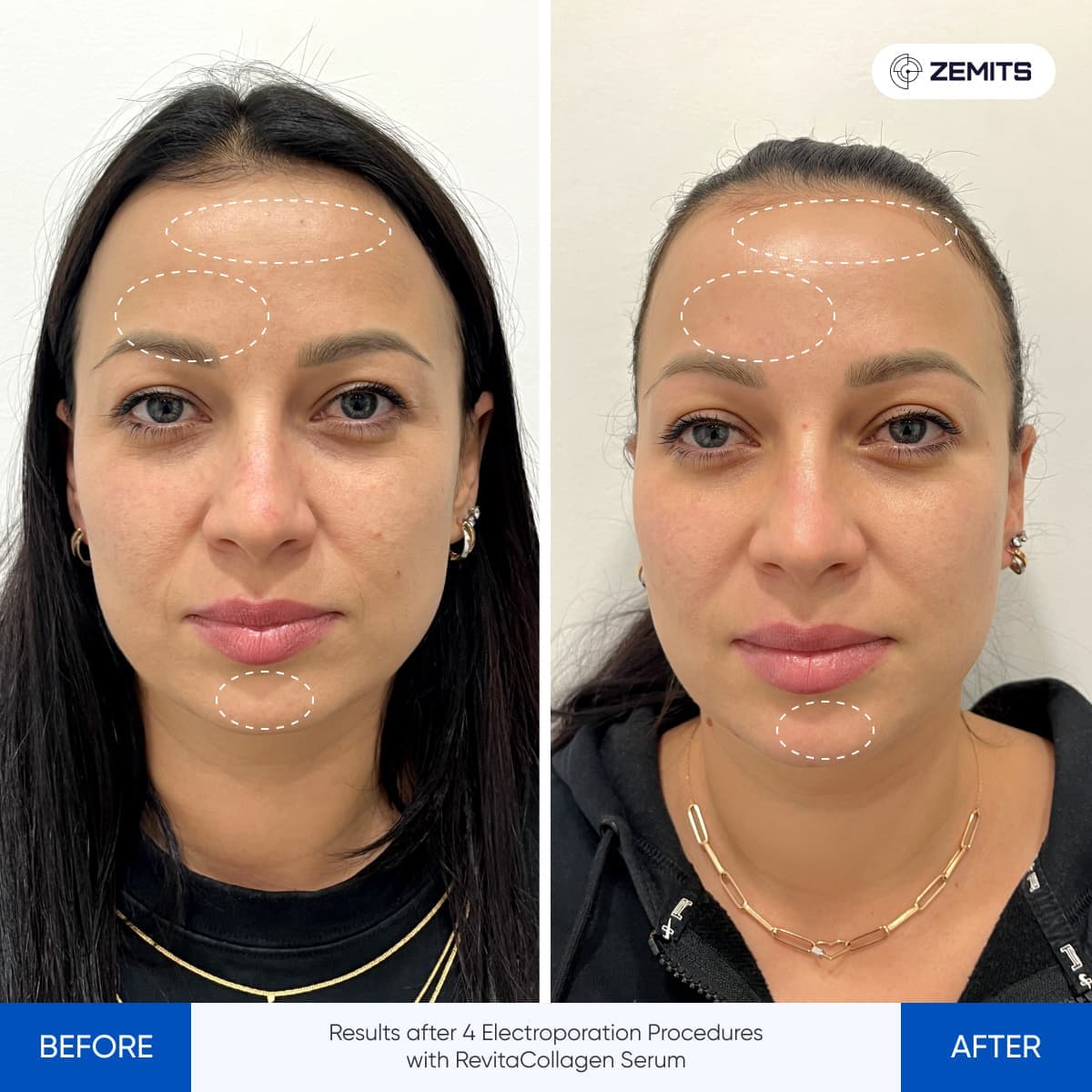 Before After Slide 2