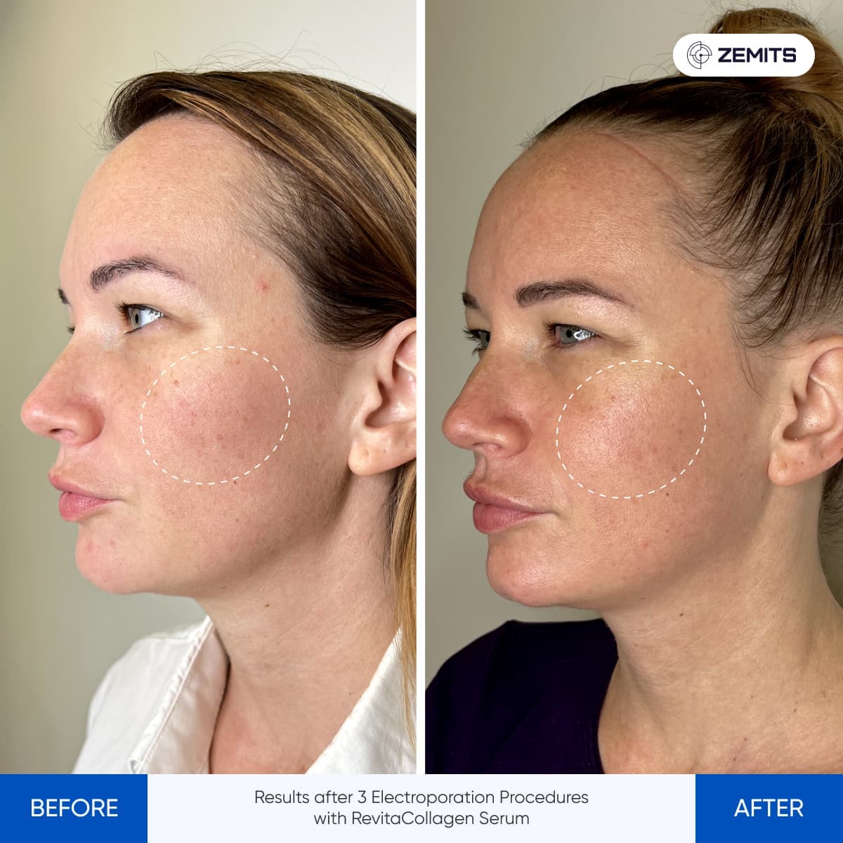 Before After Slide 3