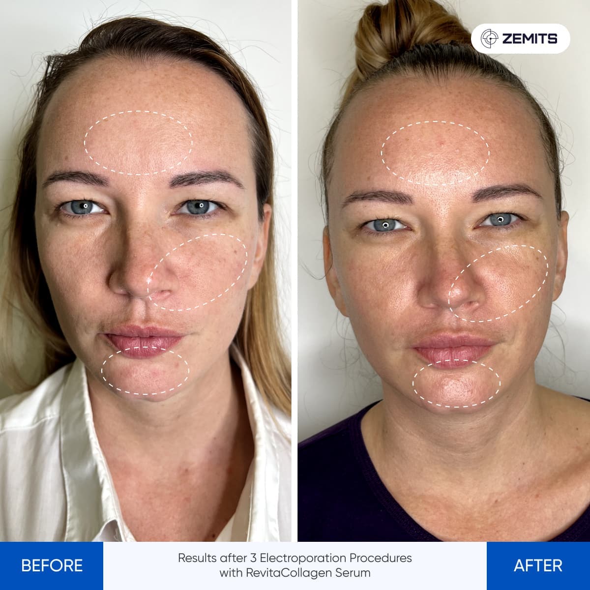 Before After Slide 4