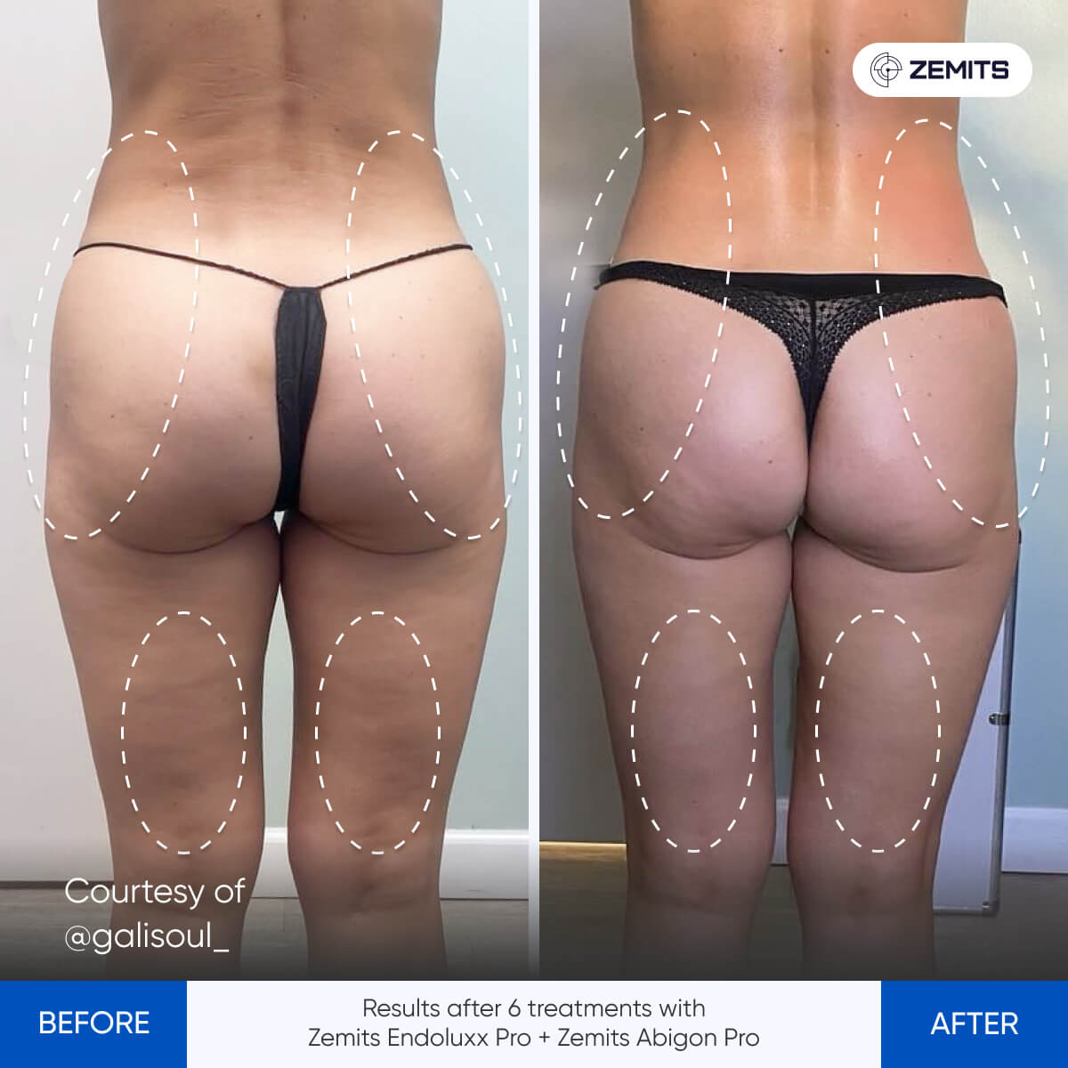 Before After Slide 4