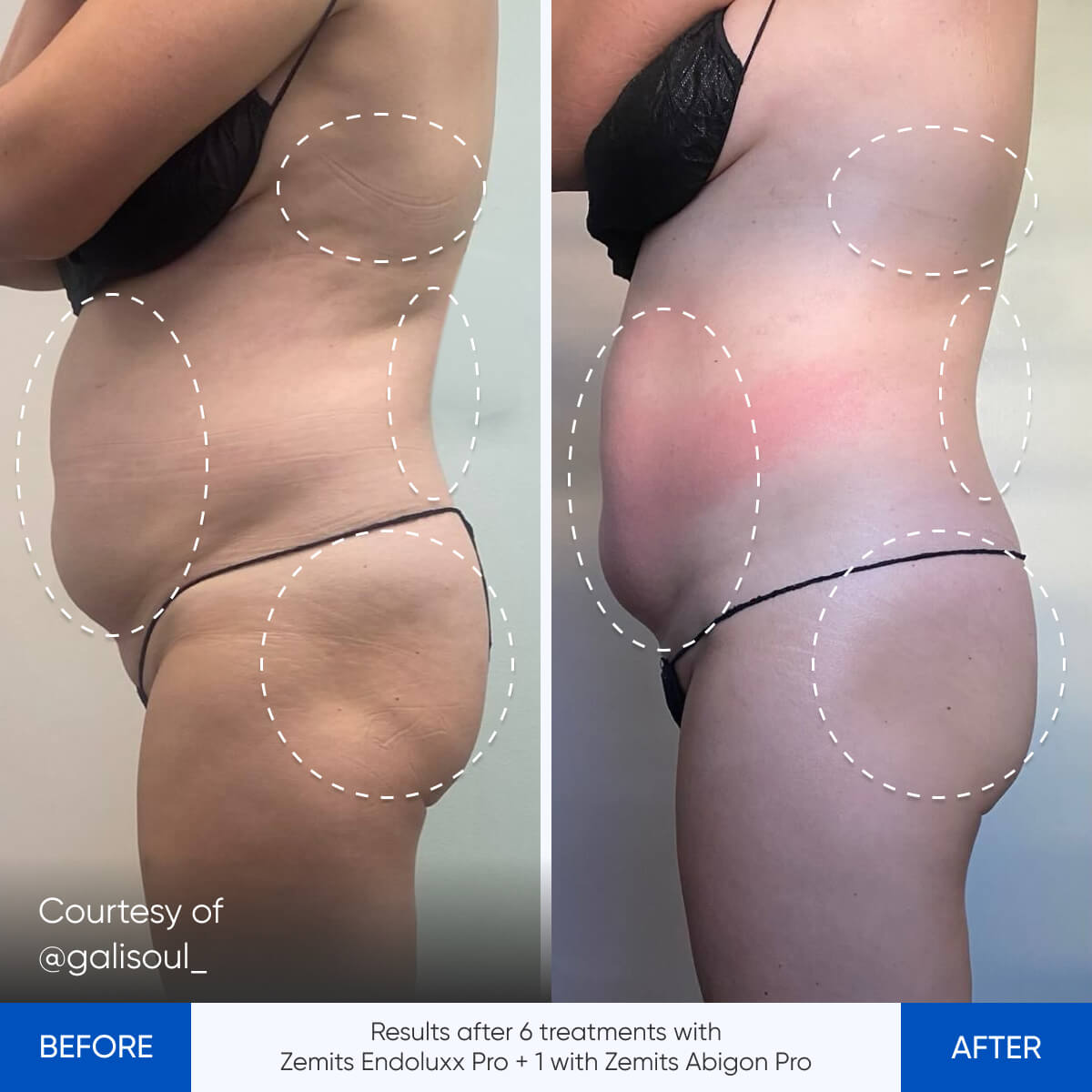 Before After Slide 5