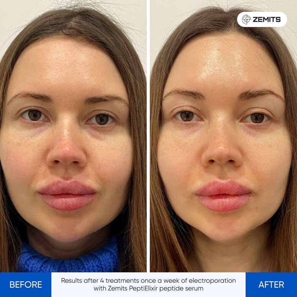 Before After Slide 1