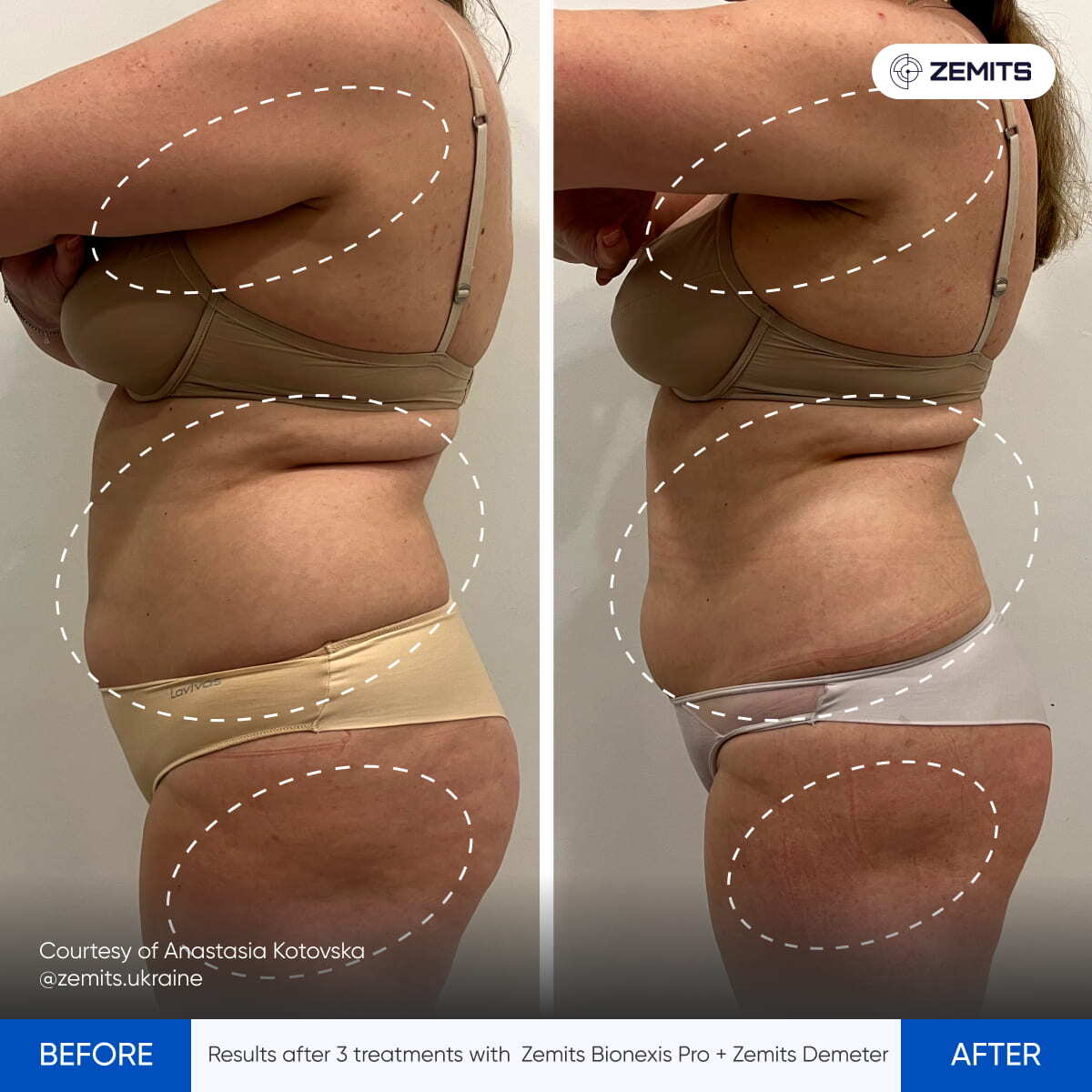 Before After Slide 1