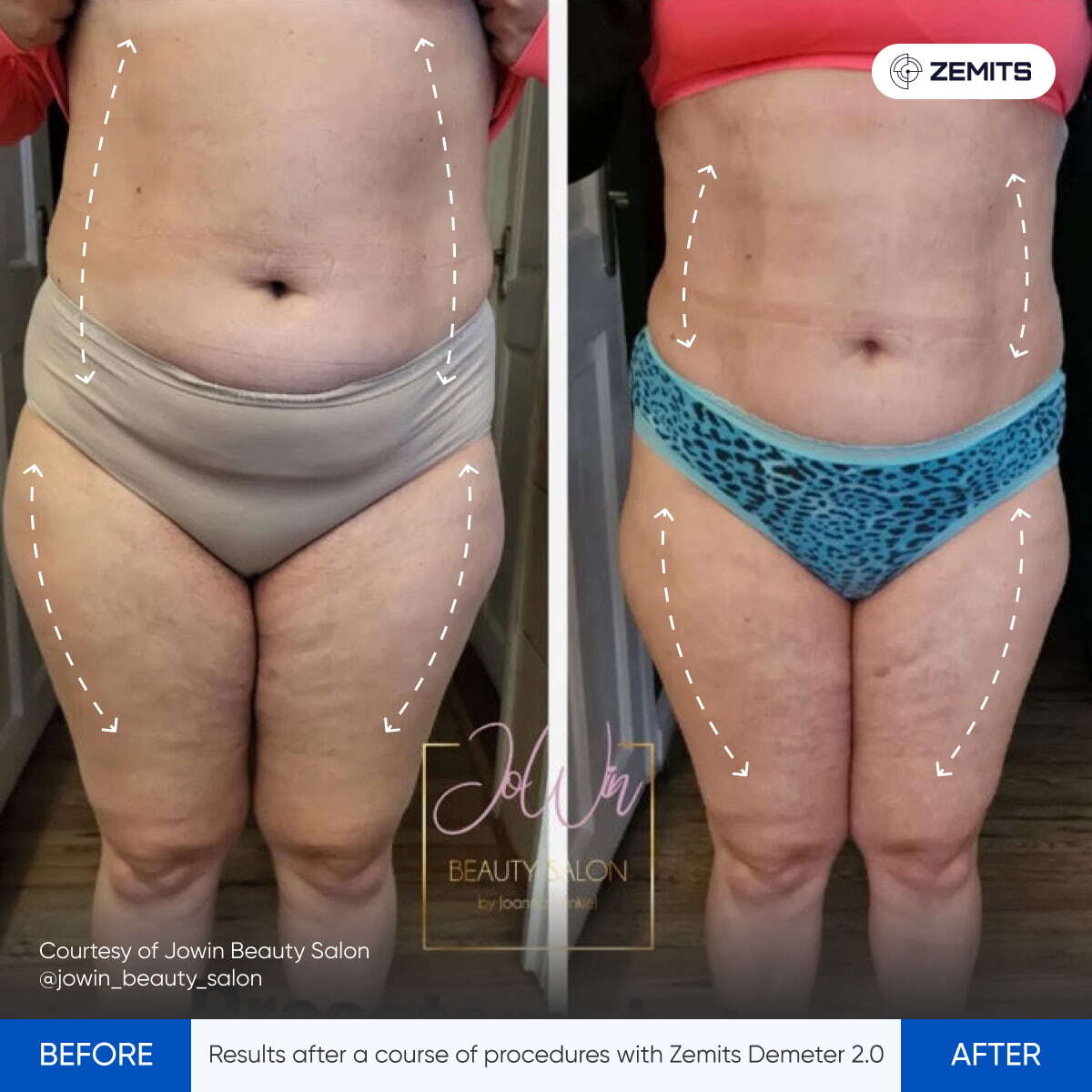 Before After Slide 3