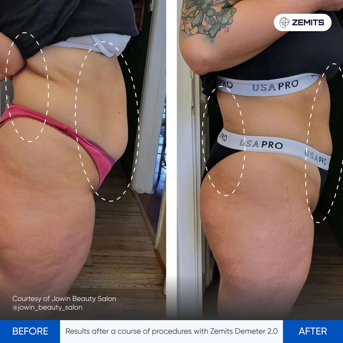 Before After Slide 4