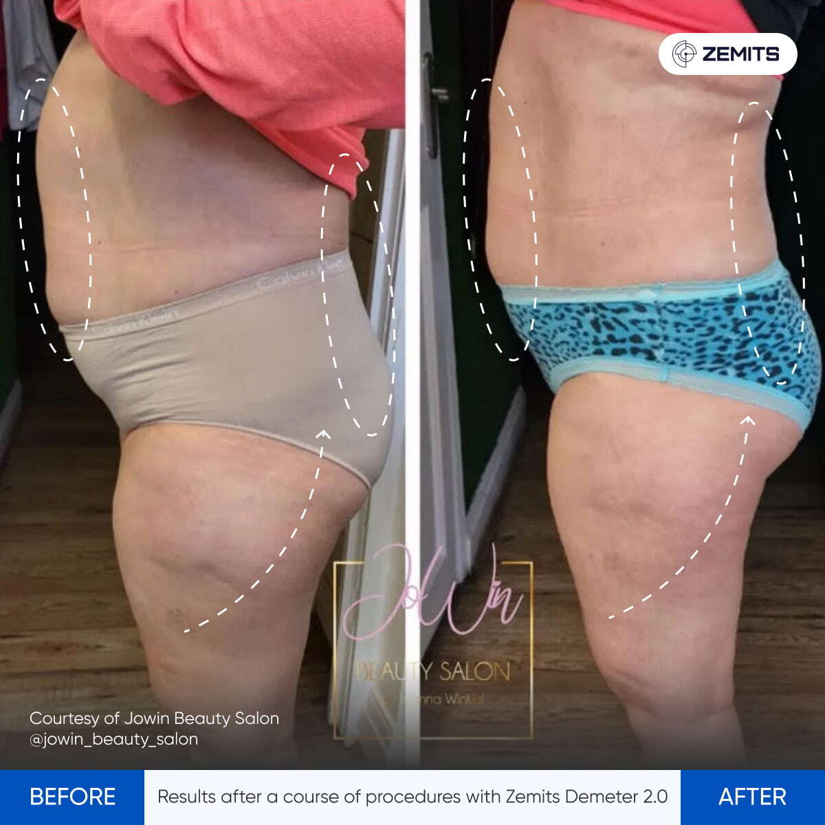 Before After Slide 6
