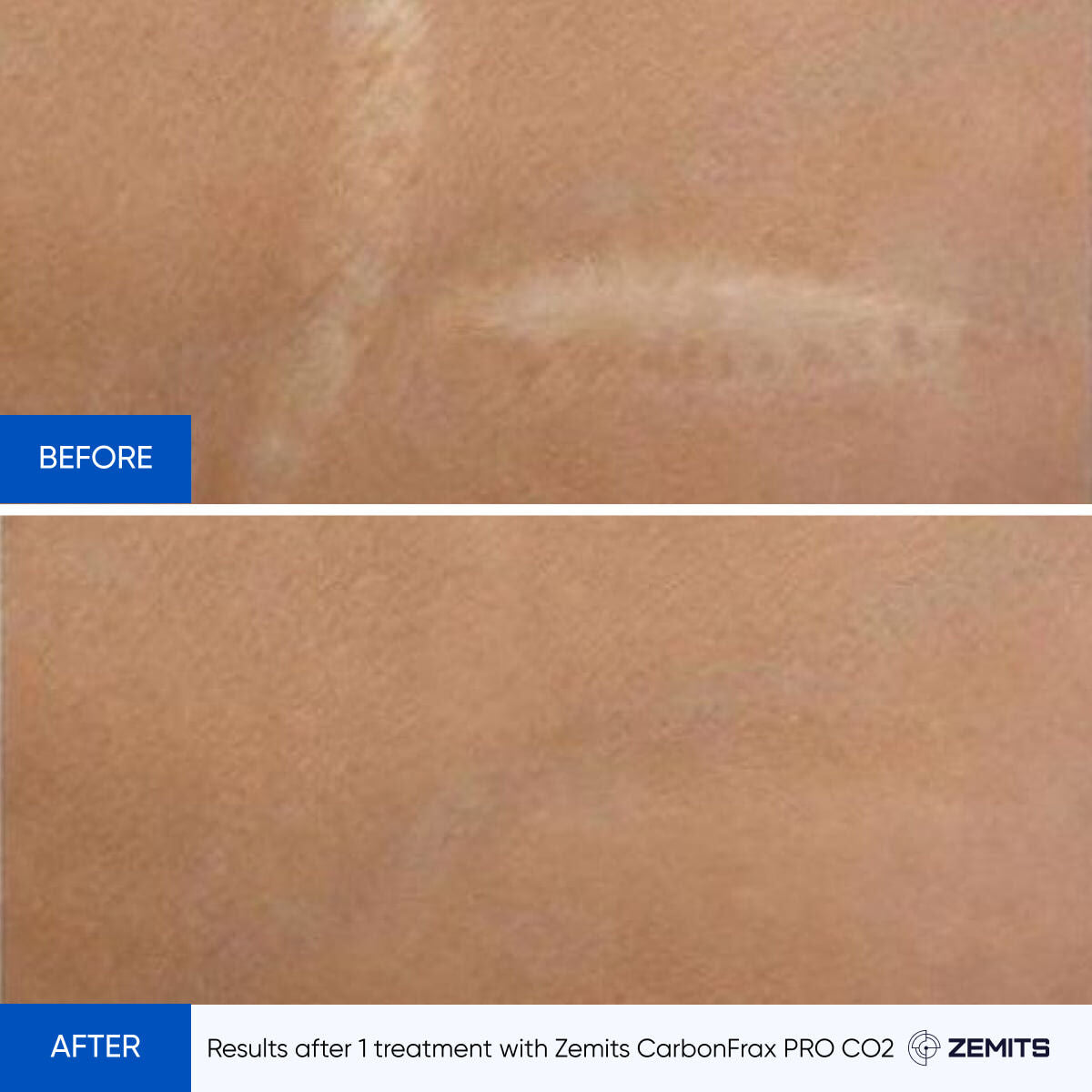 Before After Slide 2