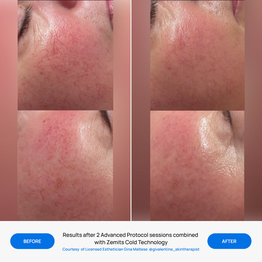 Before After Slide 5