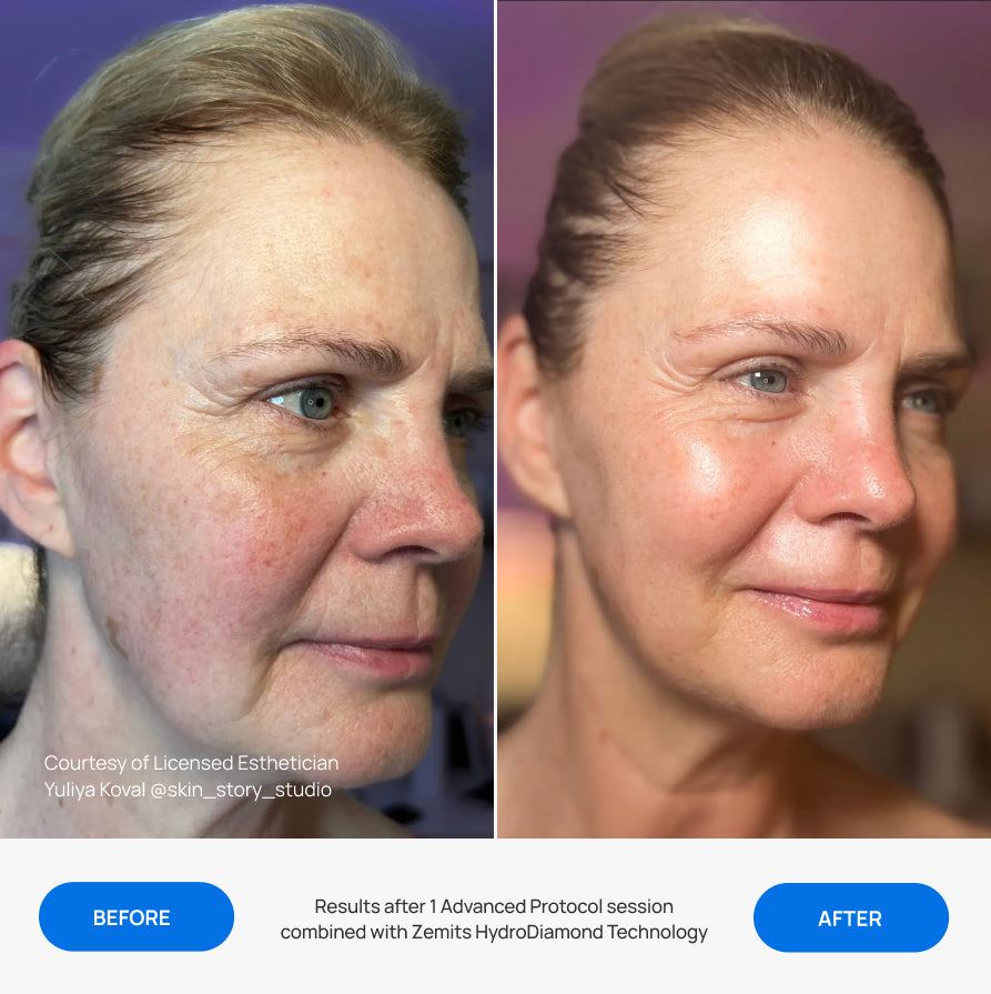 Before After Slide 1