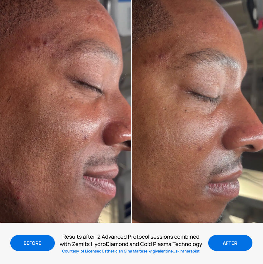Before After Slide 2