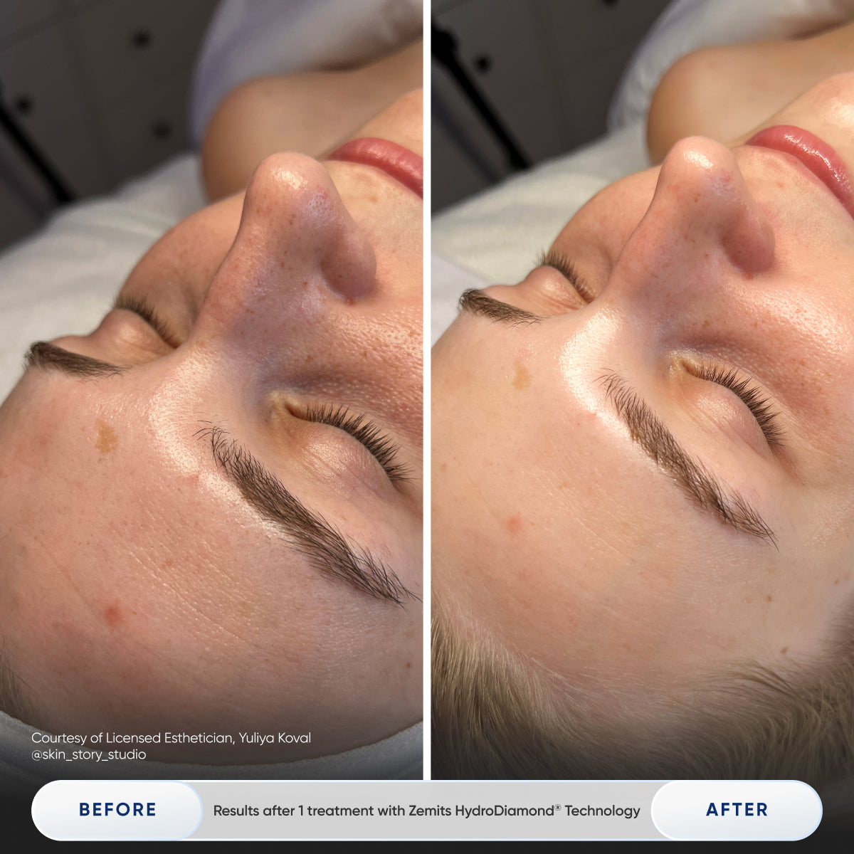 Before After Slide 4