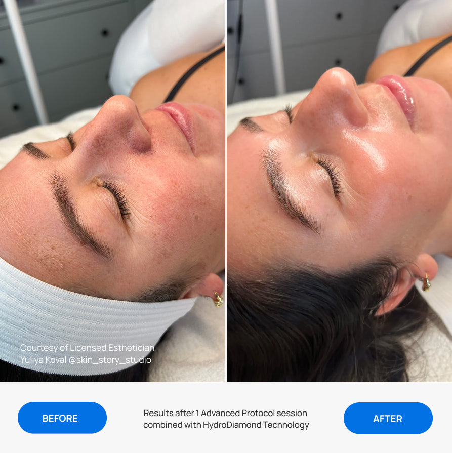 Before After Slide 5