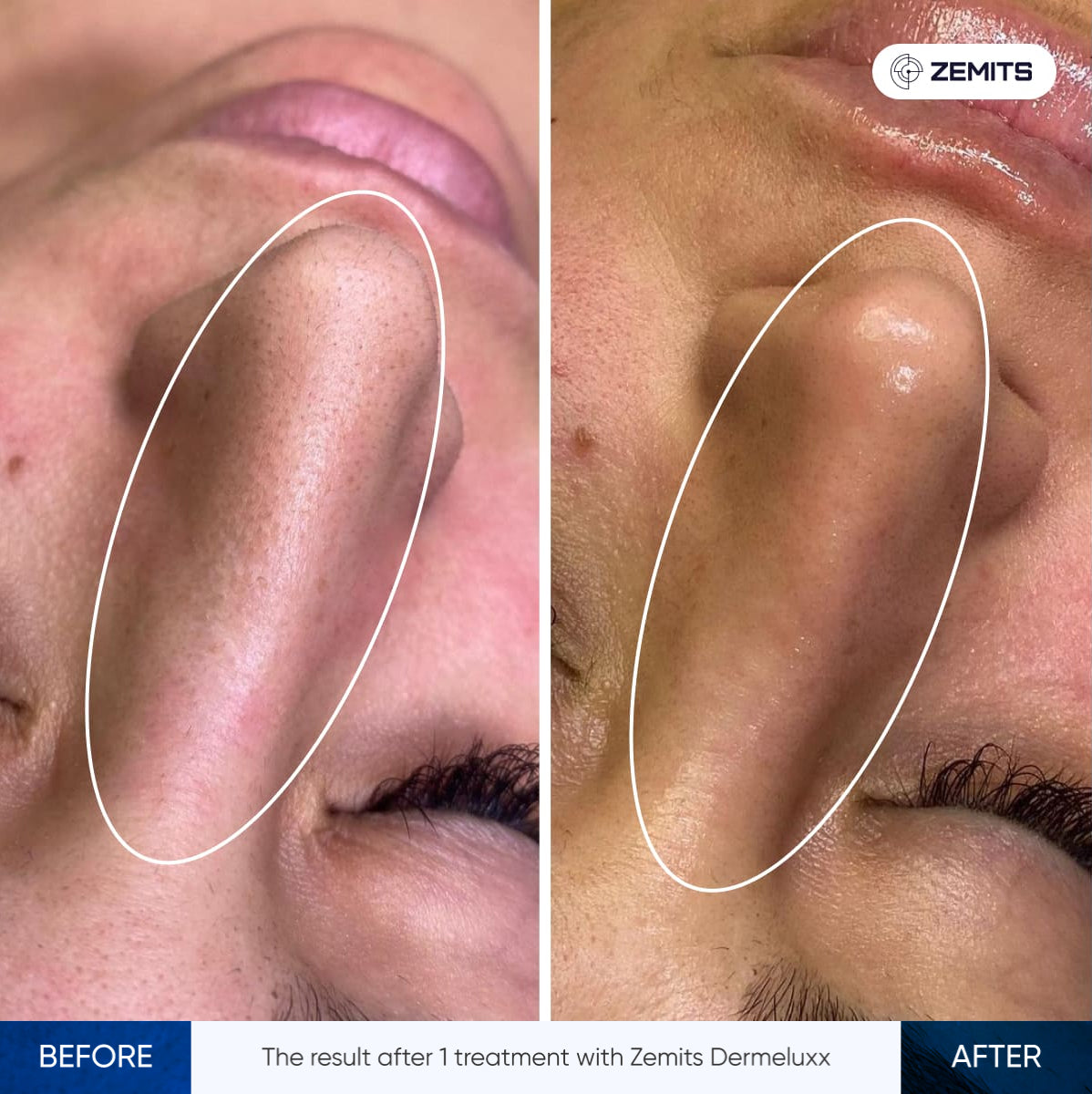 Before After Slide 1