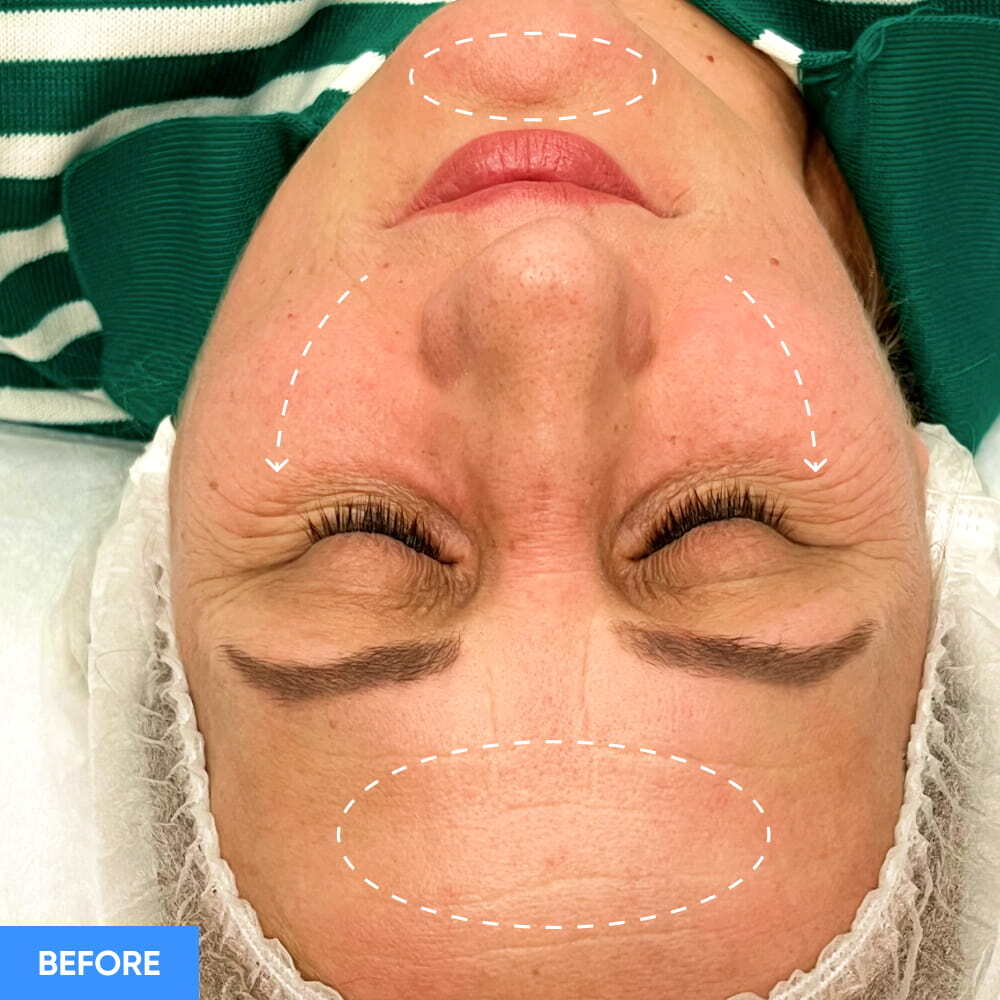 Before After Slide 1