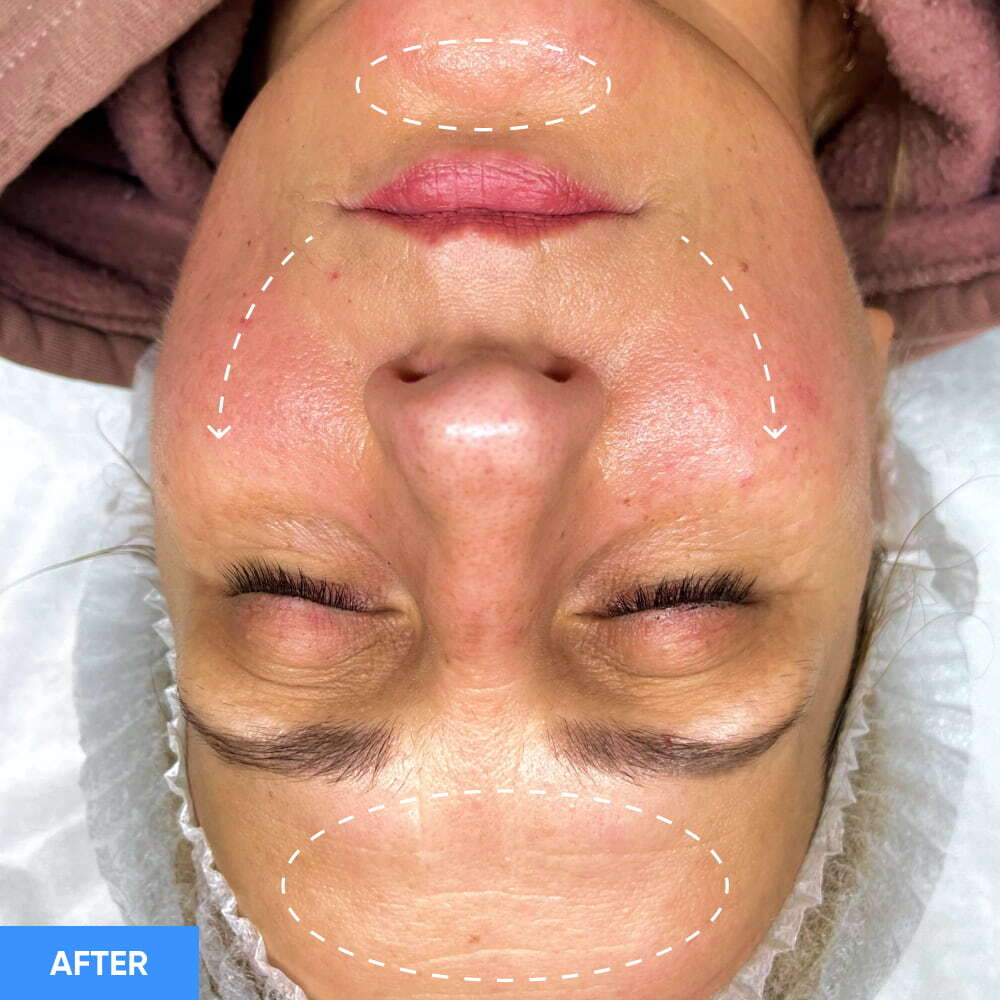 Before After Slide 2