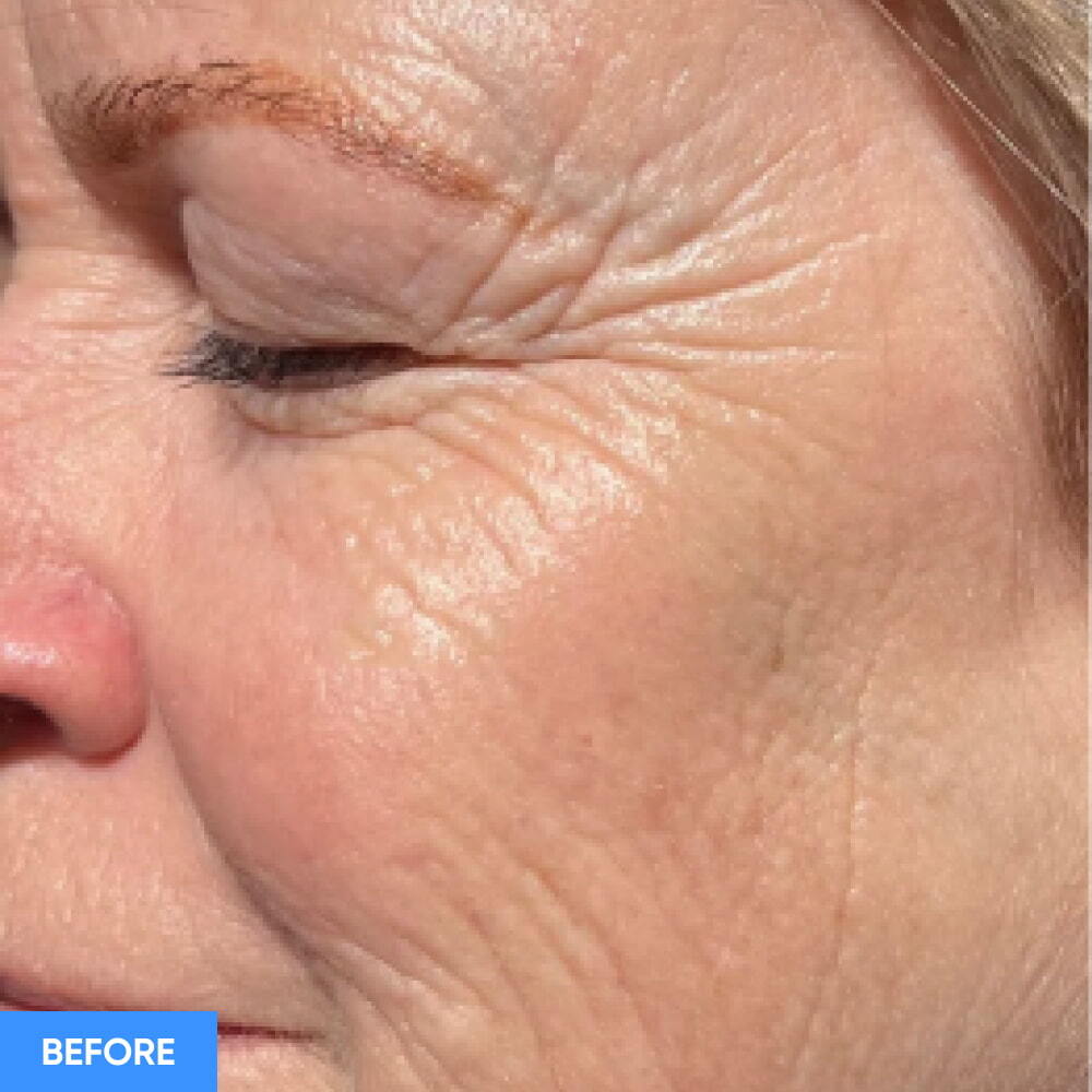 Before After Slide 1