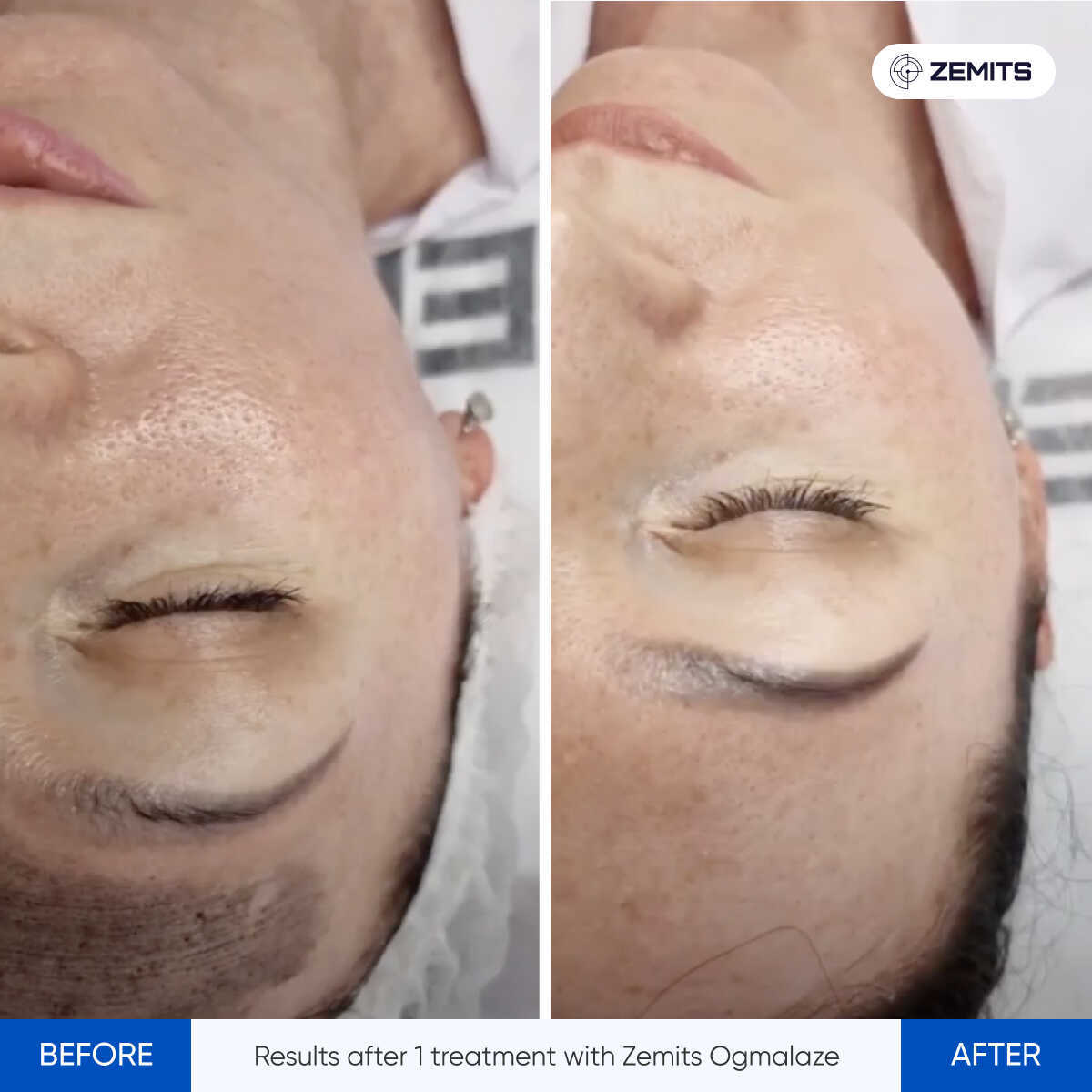 Before After Slide 7