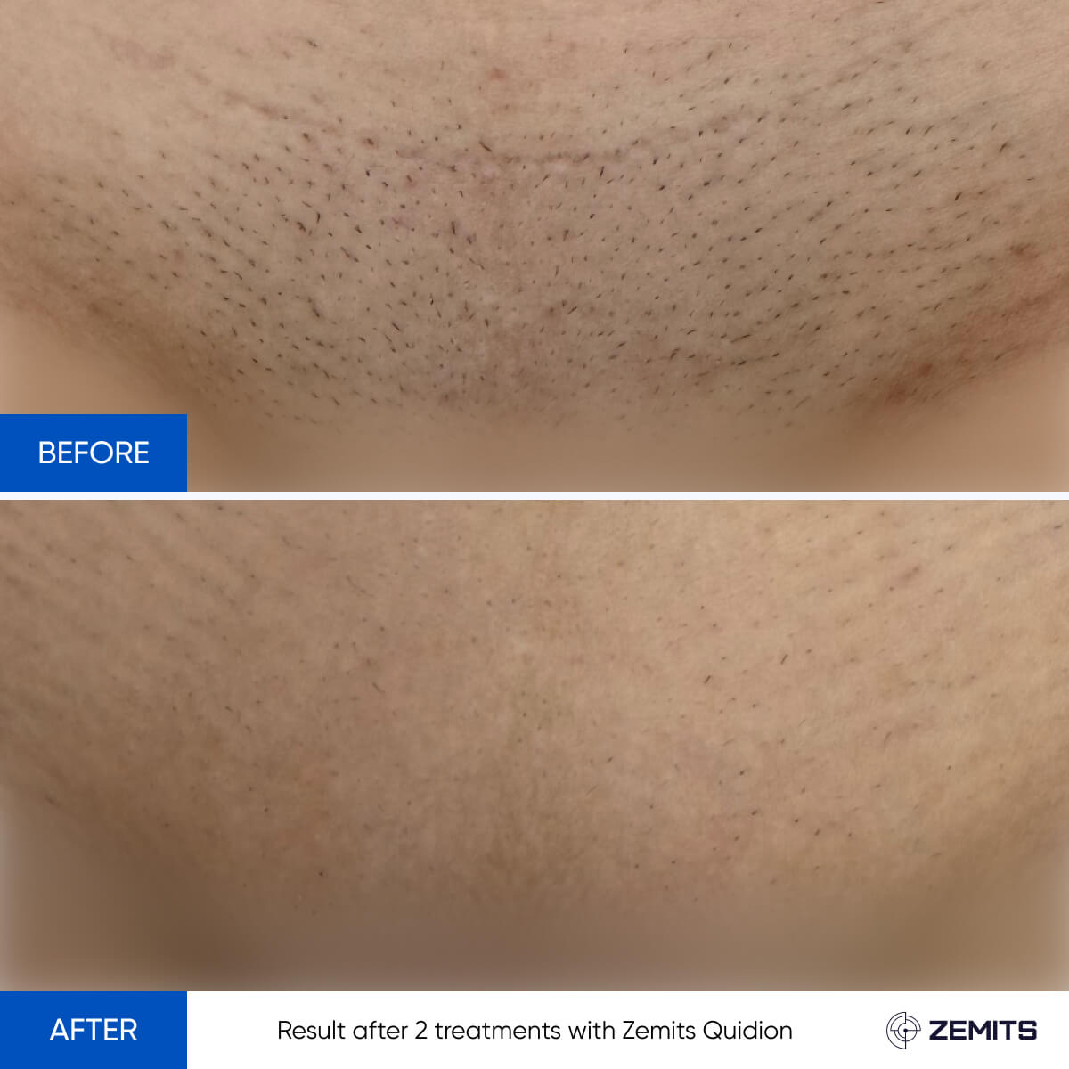Before After Slide 4