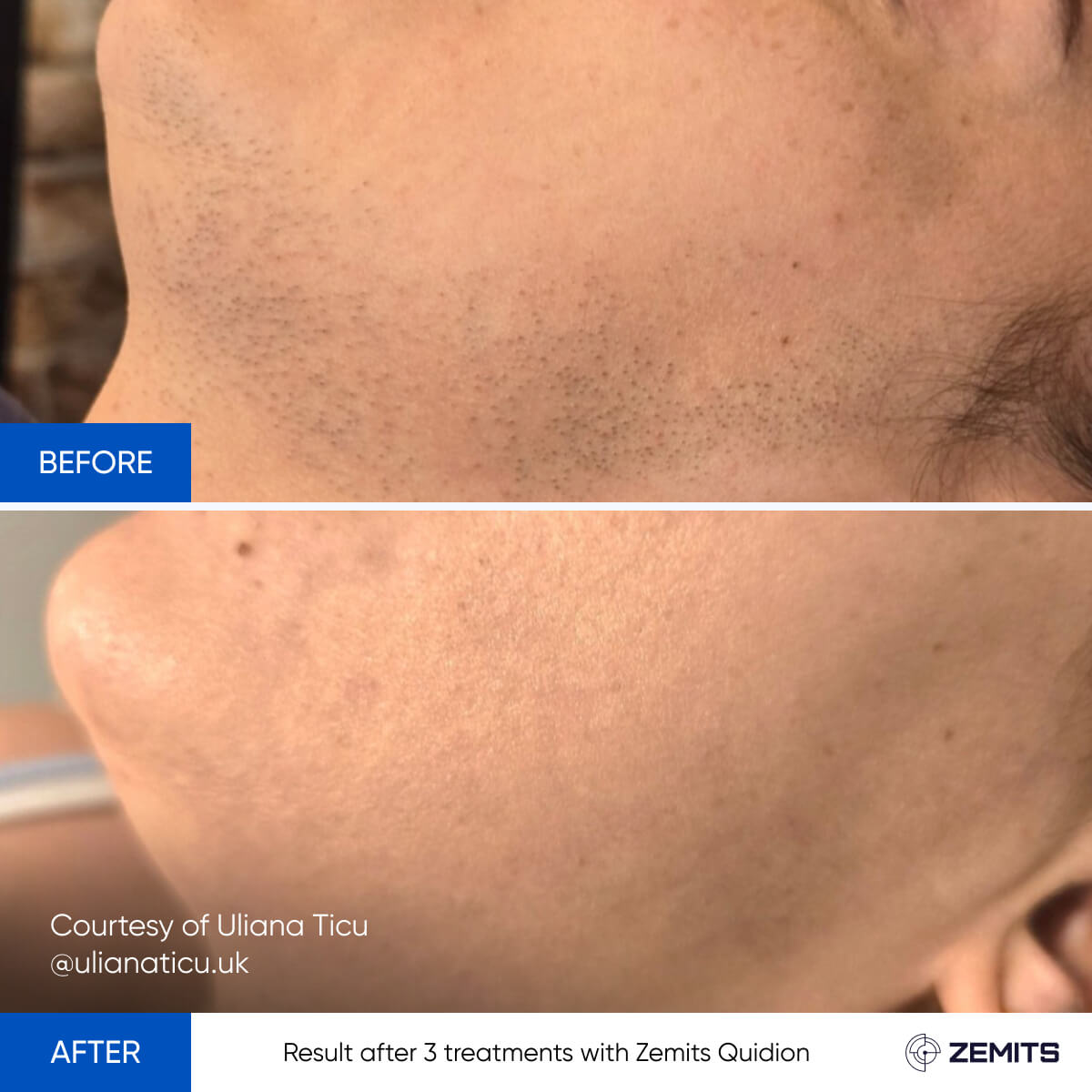 Before After Slide 5