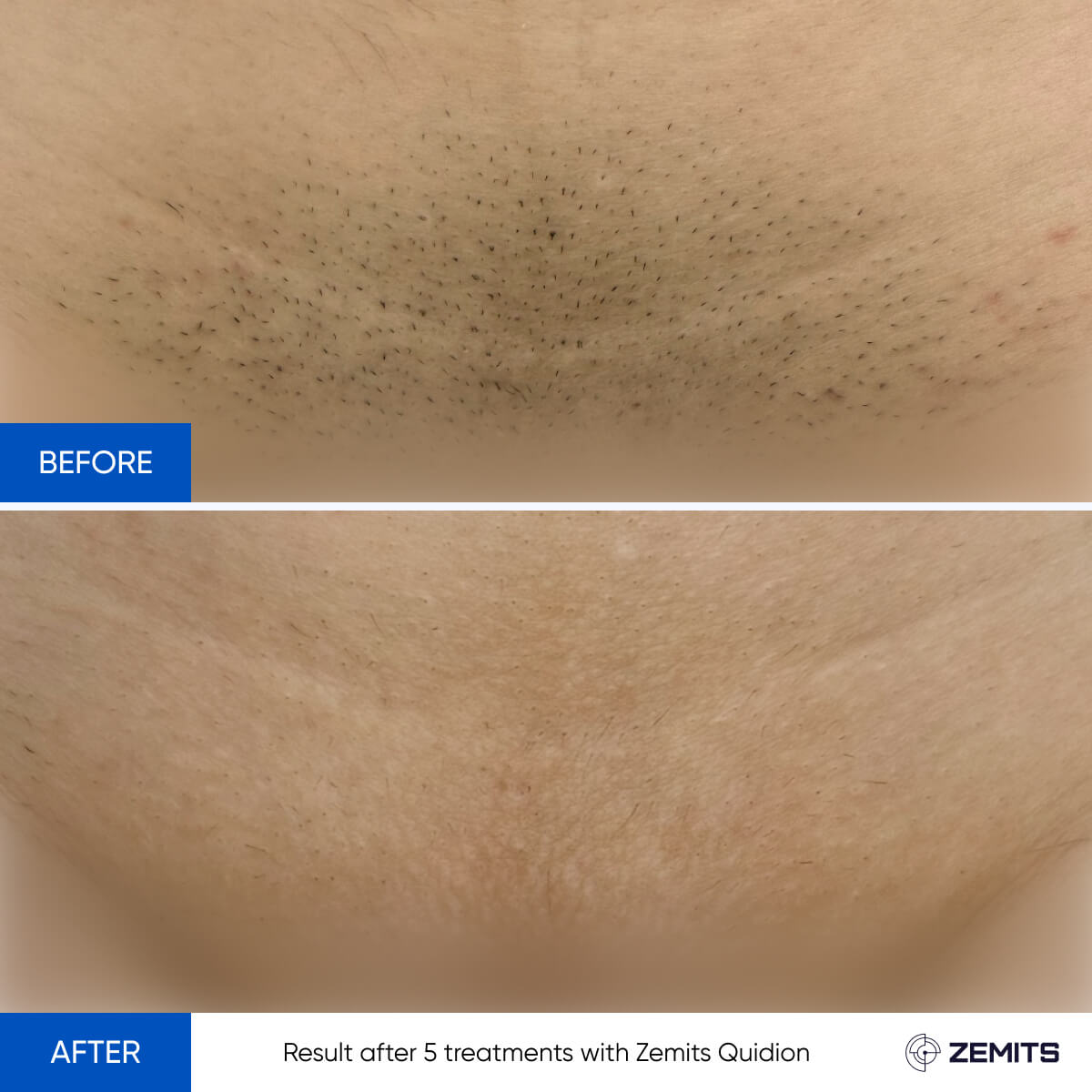 Before After Slide 6