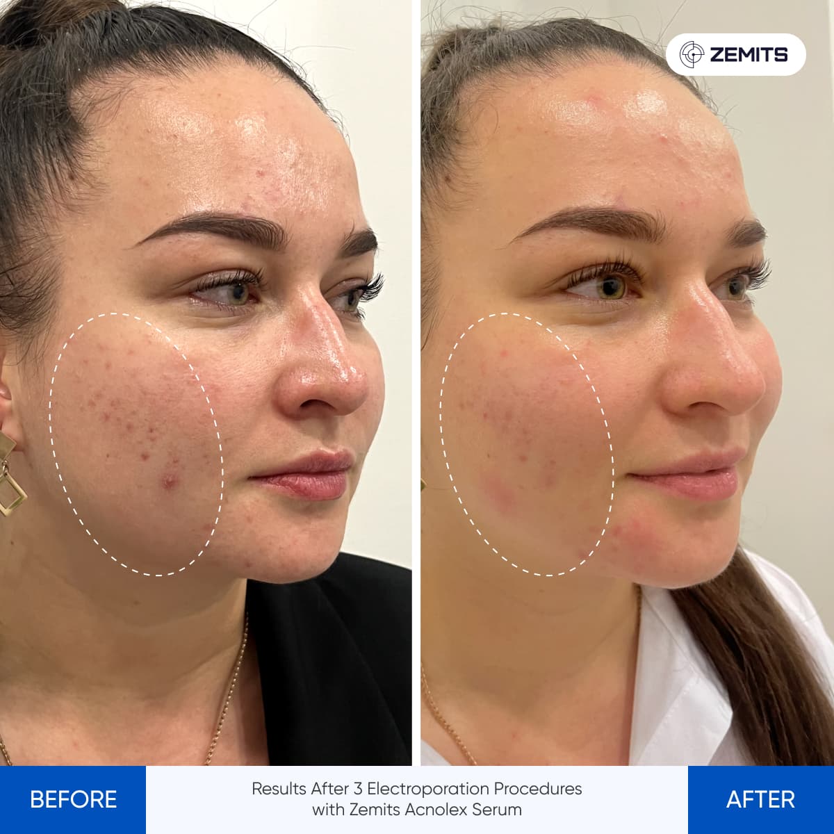 Before After Slide 4