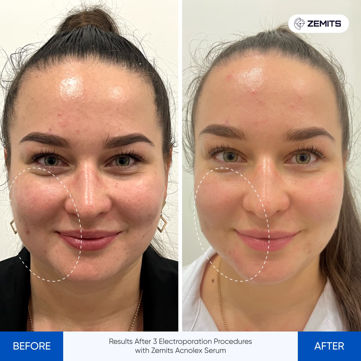 Before After Slide 3