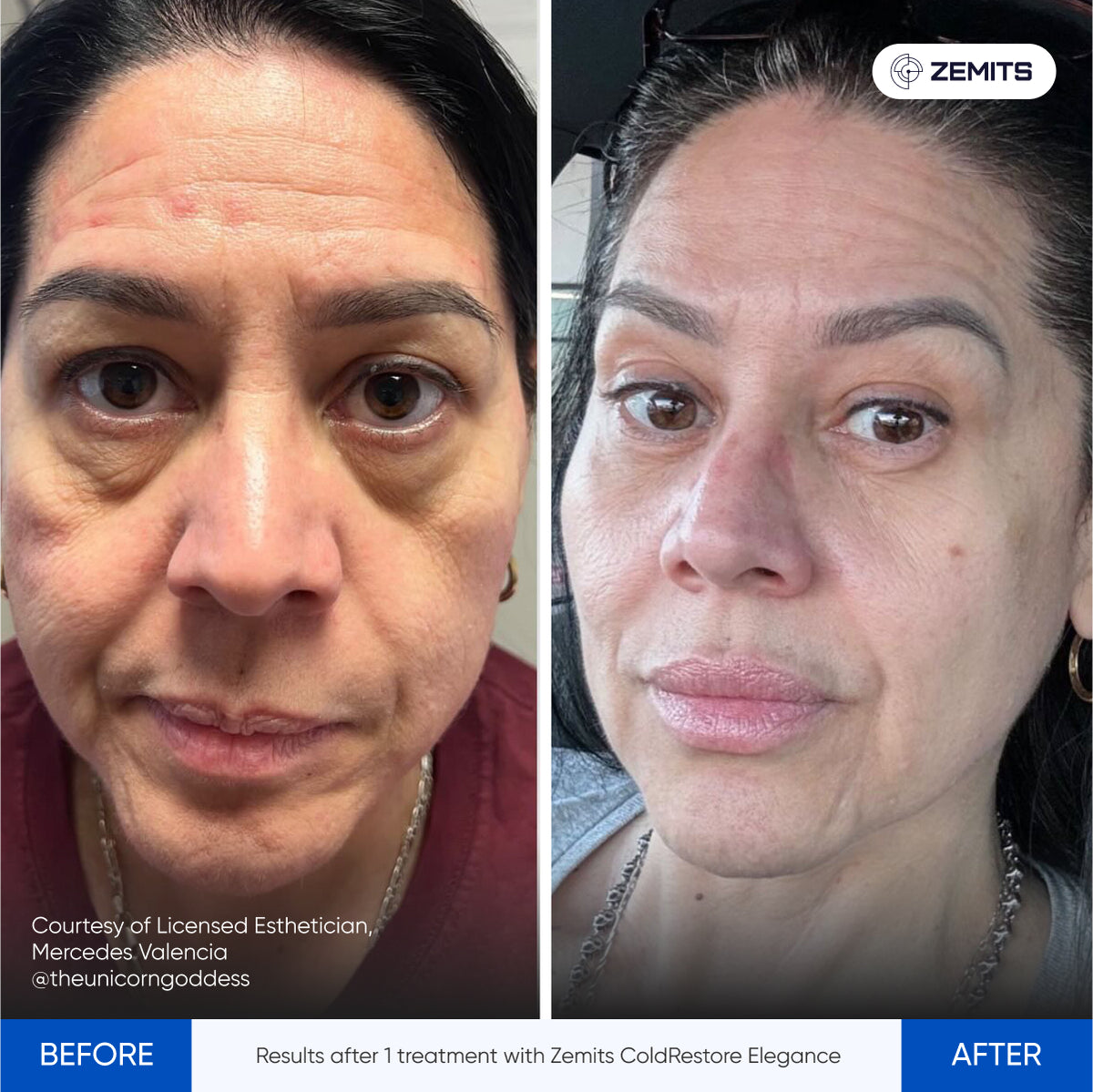 Before After Slide 19