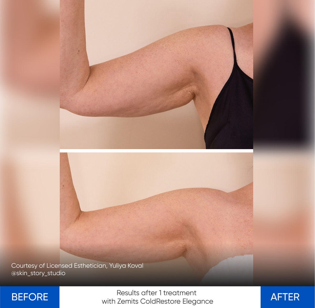 Before After Slide 4