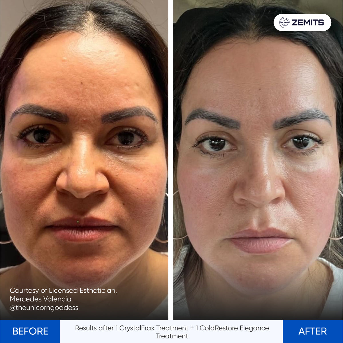 Before After Slide 12