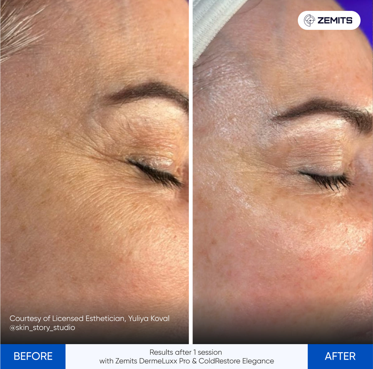 Before After Slide 3