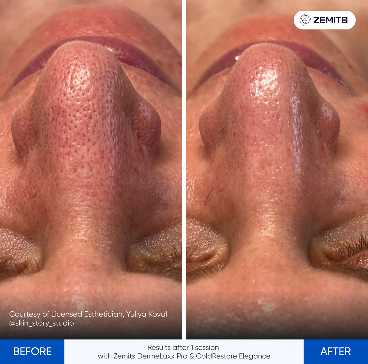 Before After Slide 16
