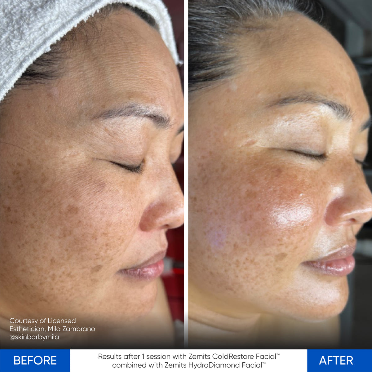 Before After Slide 1