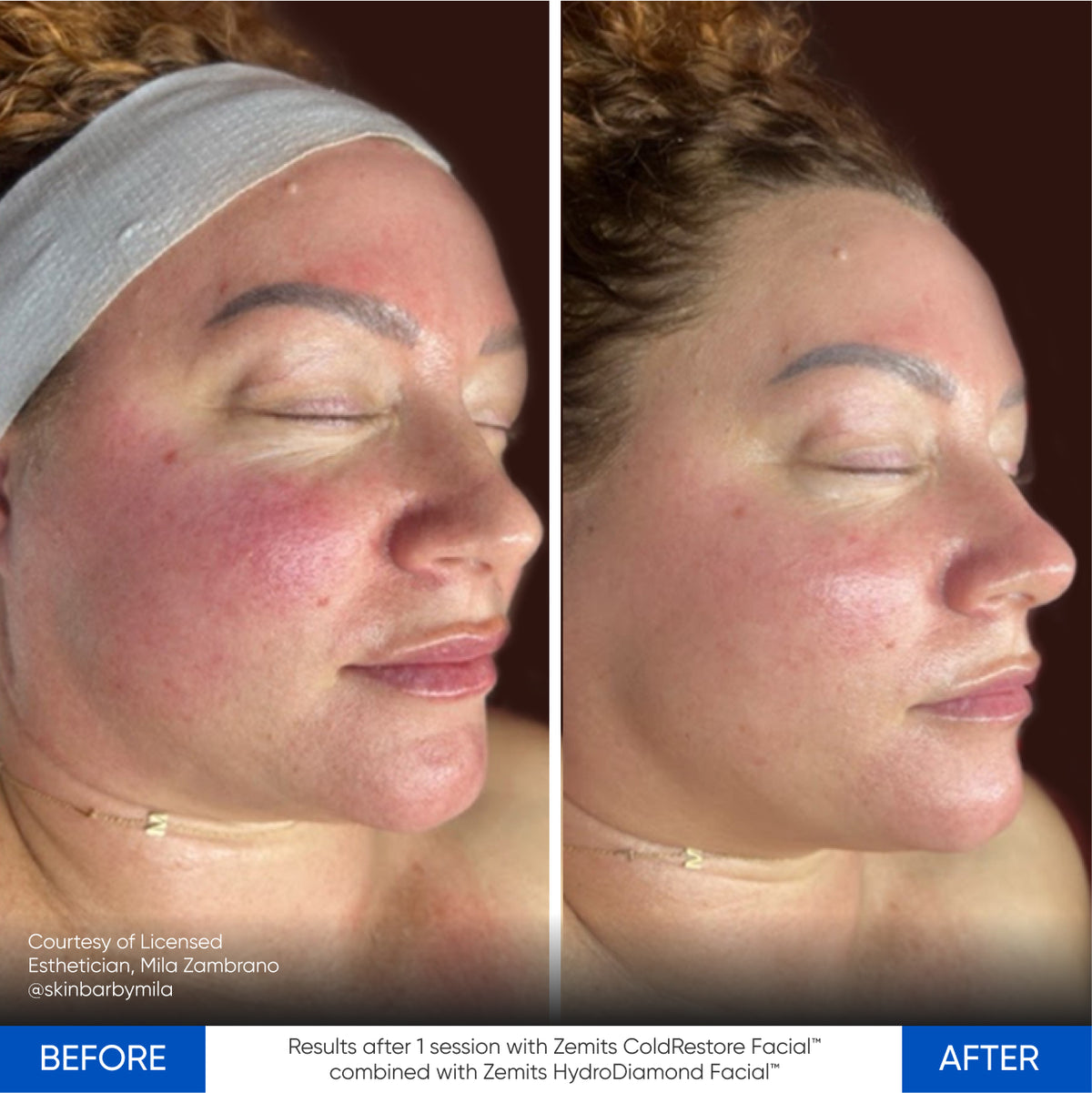 Before After Slide 2