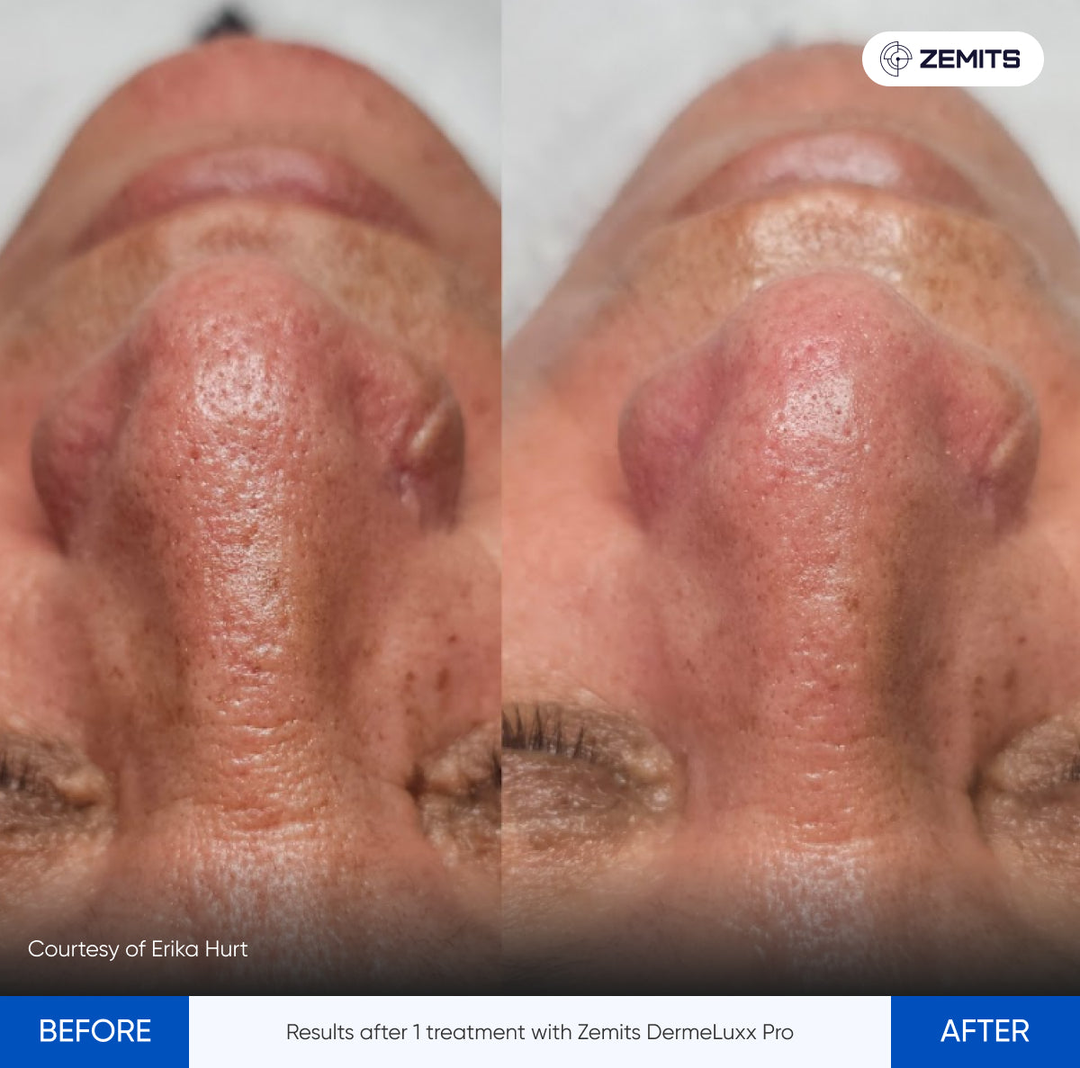 Before After Slide 6