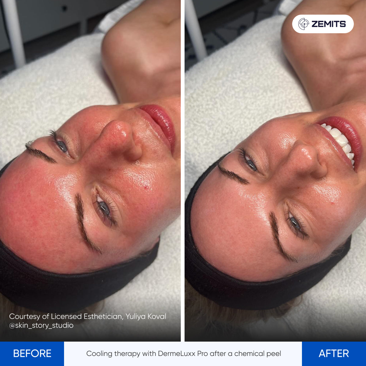 Before After Slide 8