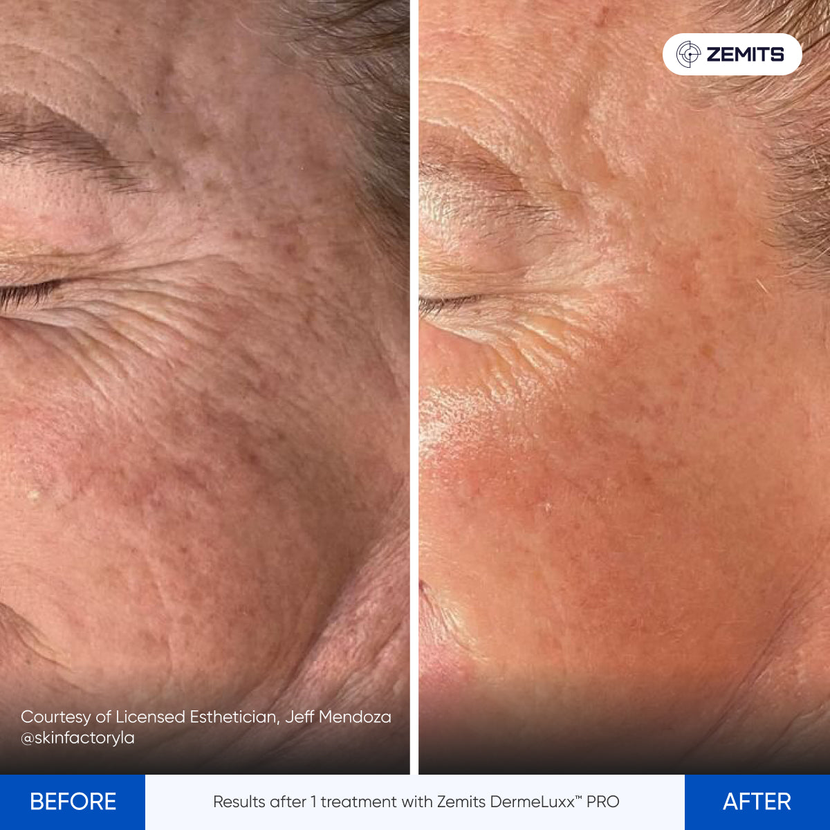 Before After Slide 9