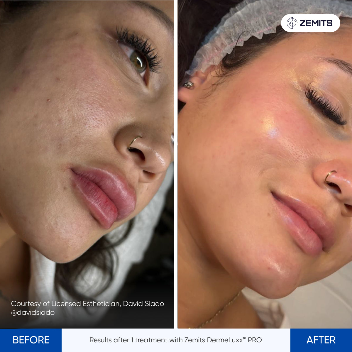 Before After Slide 10