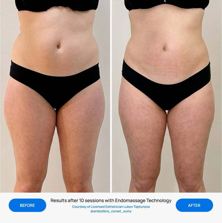 Before After Slide 4