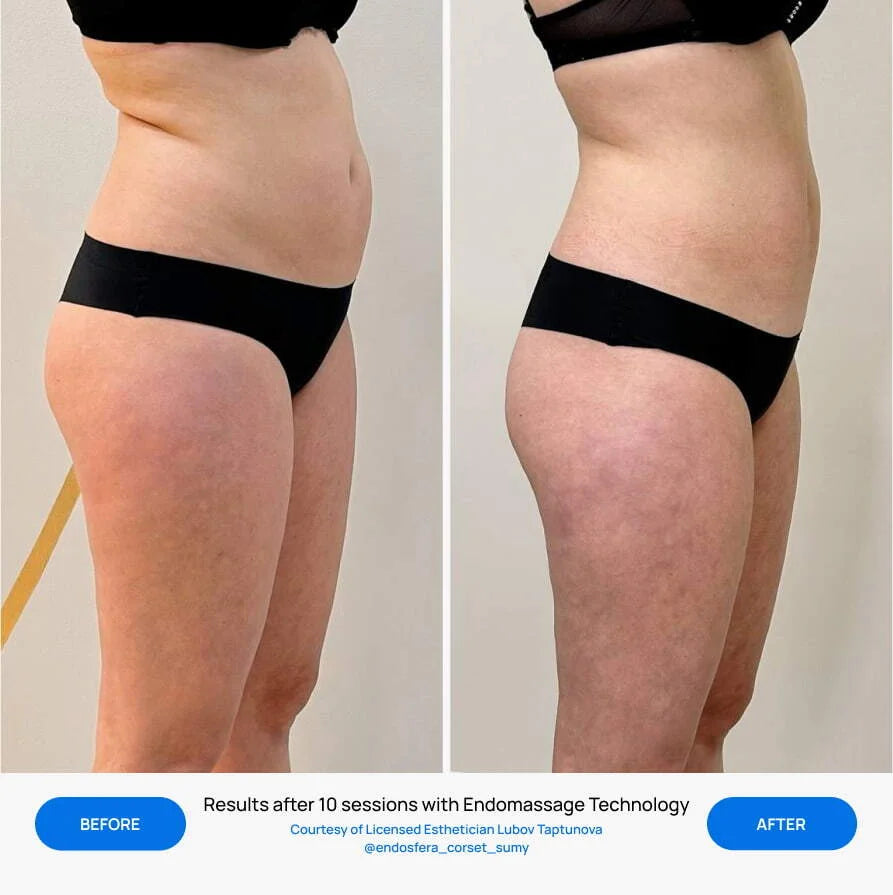 Before After Slide 3