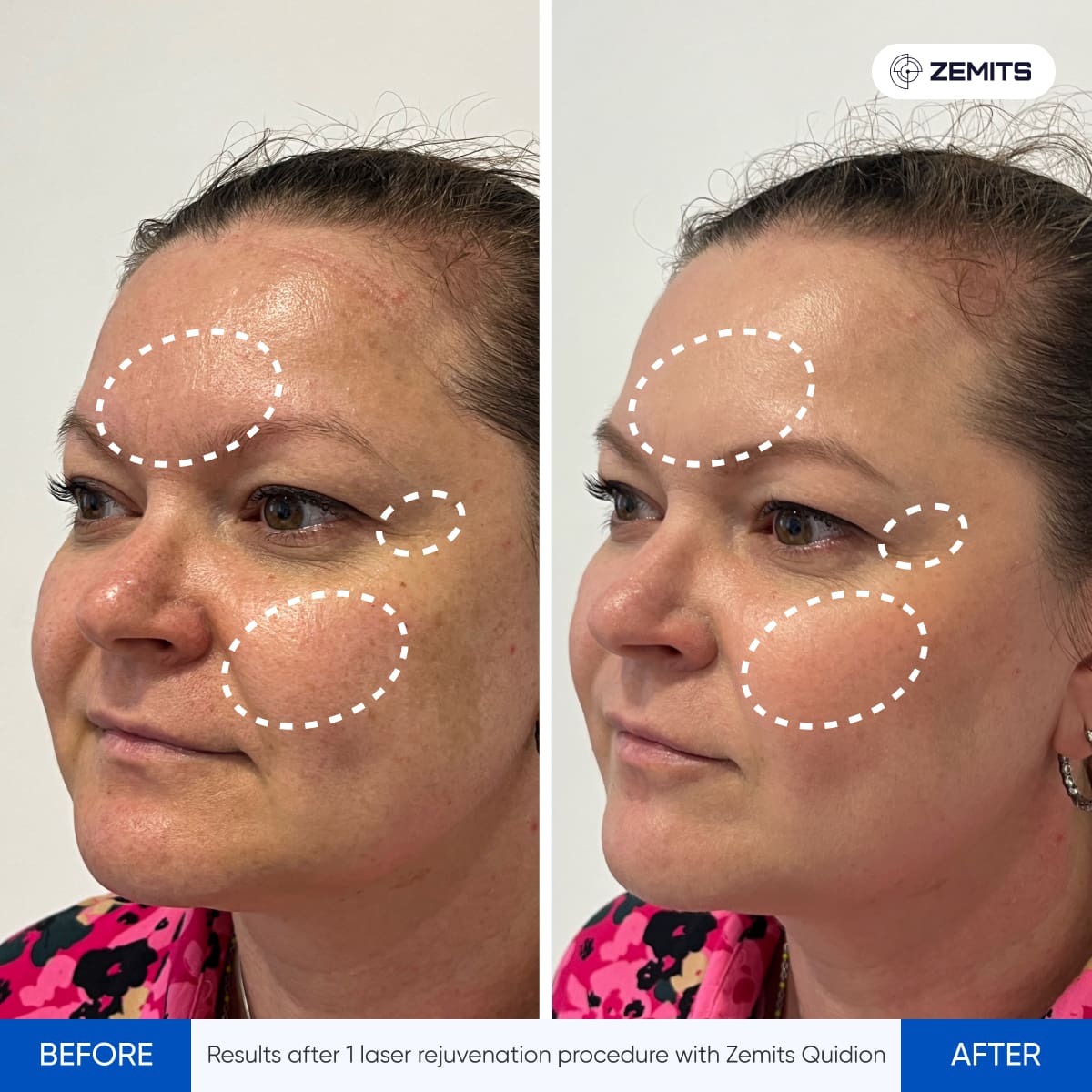 Before After Slide 9