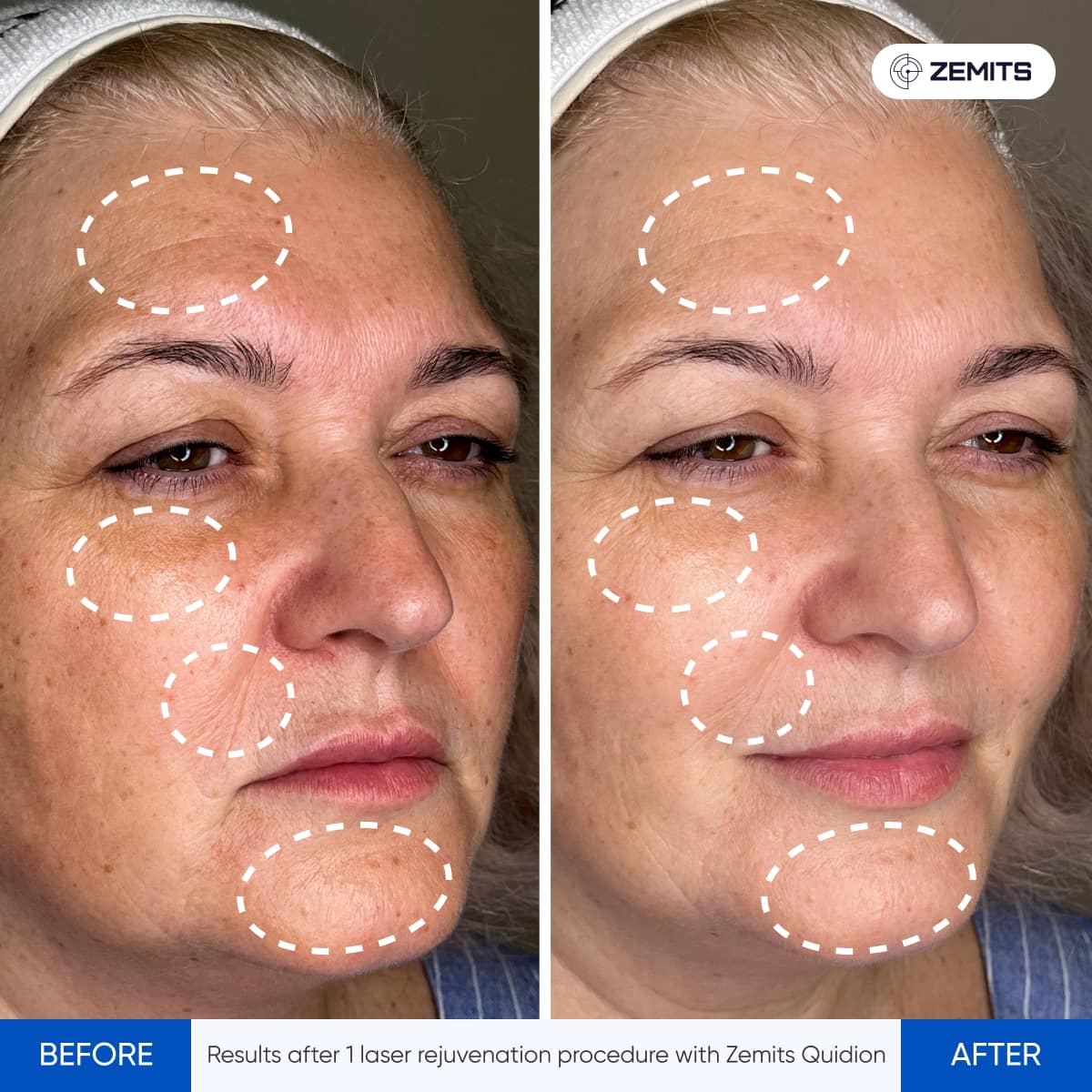 Before After Slide 8