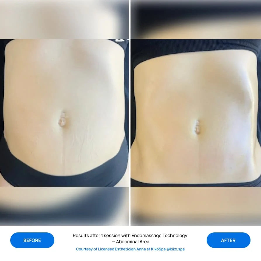 Before After Slide 2