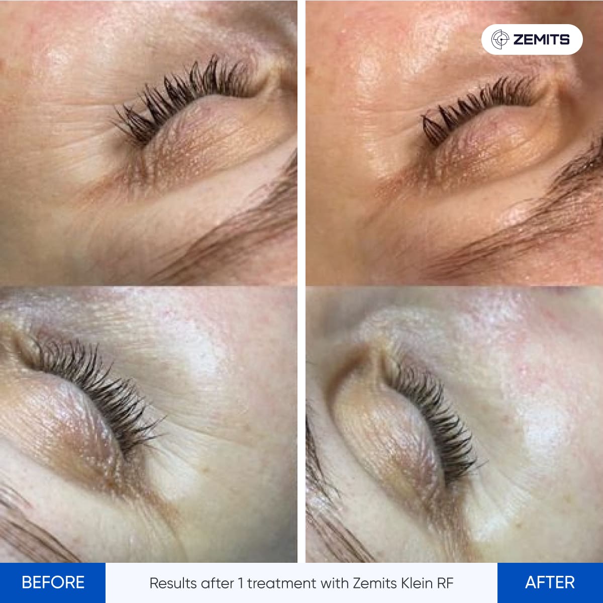 Before After Slide 7