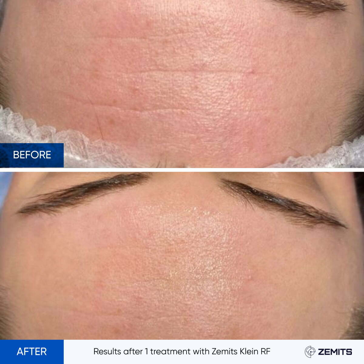 Before After Slide 12