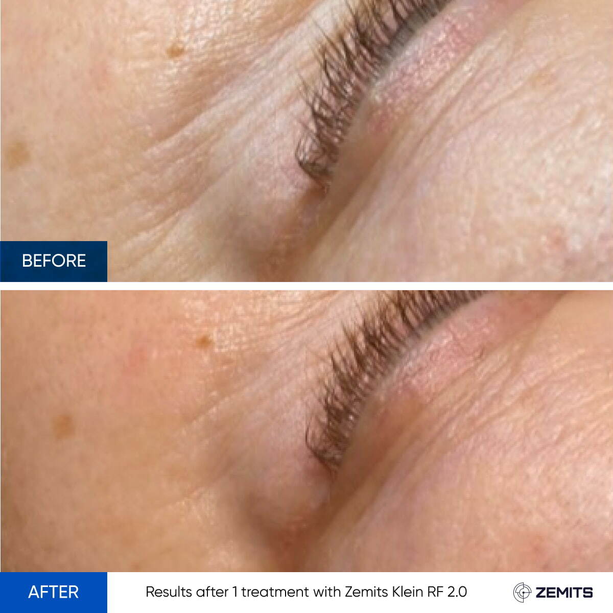 Before After Slide 6