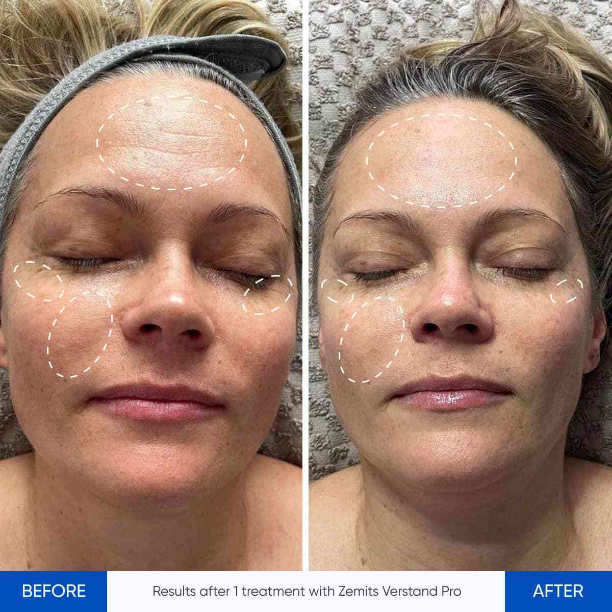 Before After Slide 2