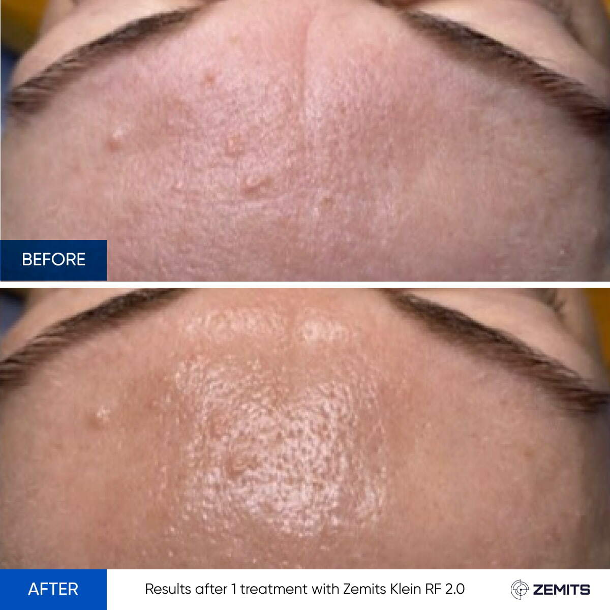 Before After Slide 8